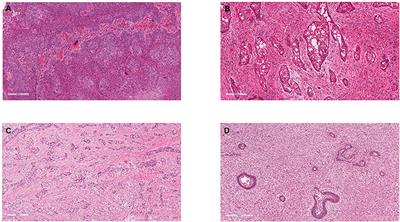 Malignant Odontogenic Tumours: A Systematic Review of Cases Reported in Literature